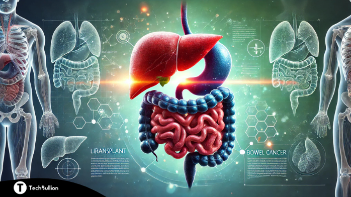 Liver Transplant and Bowel Cancer